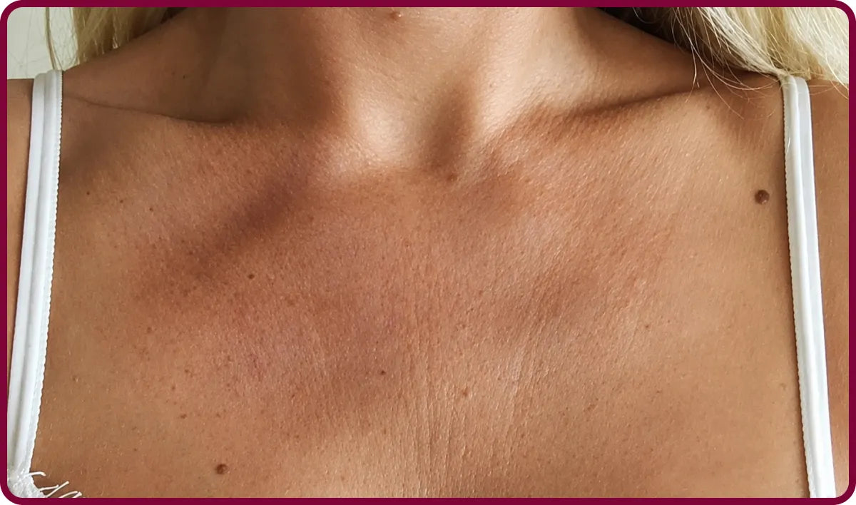 image comparison before