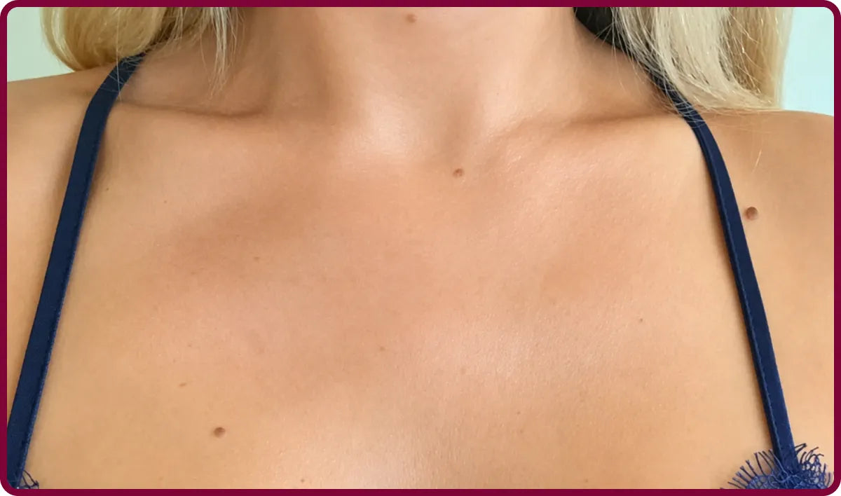 image comparison after
