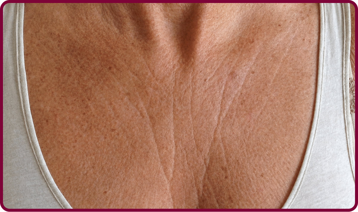 image comparison before