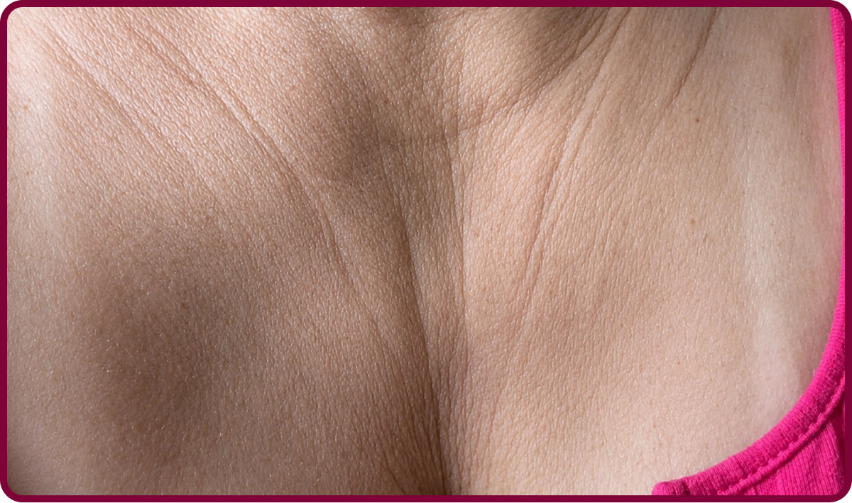 image comparison before