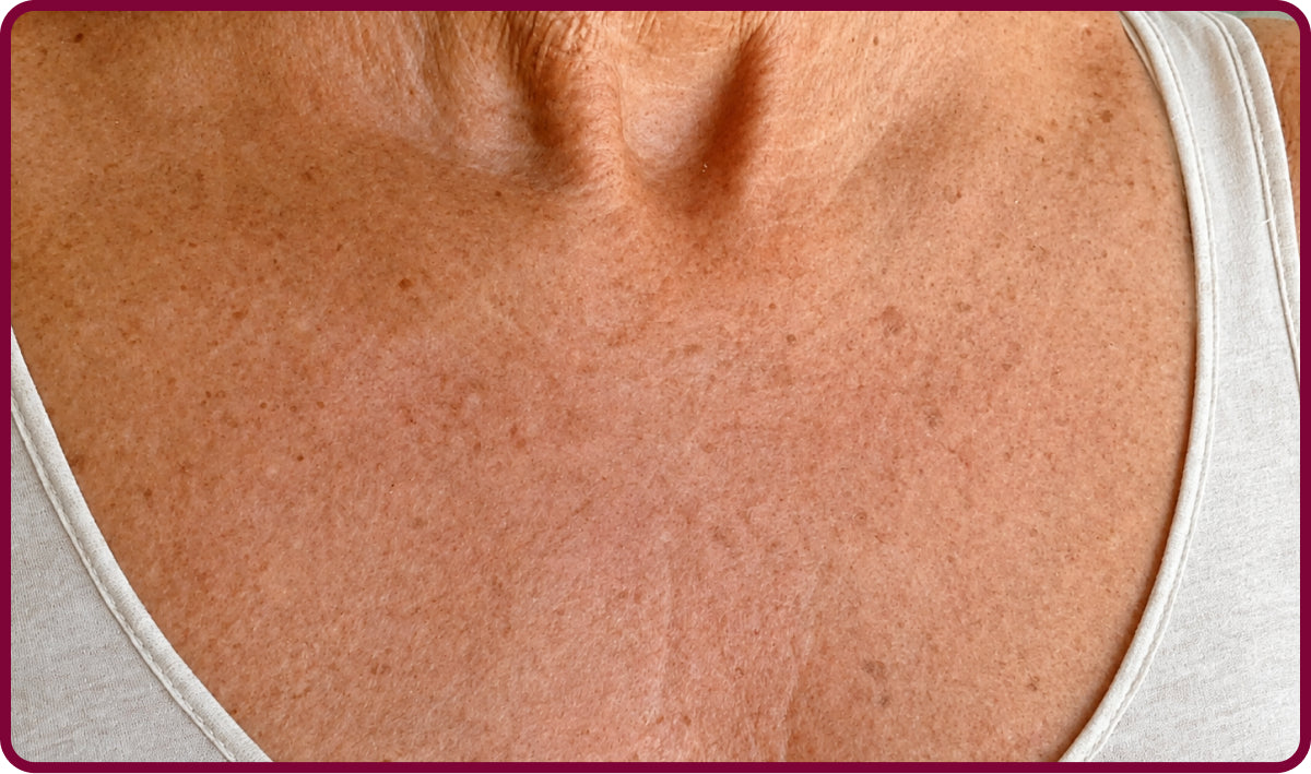 image comparison after